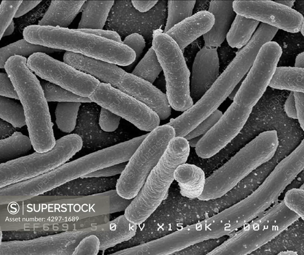 Scanning electron micrograph of Escherichia coli, grown in culture and adhered to a coverslip