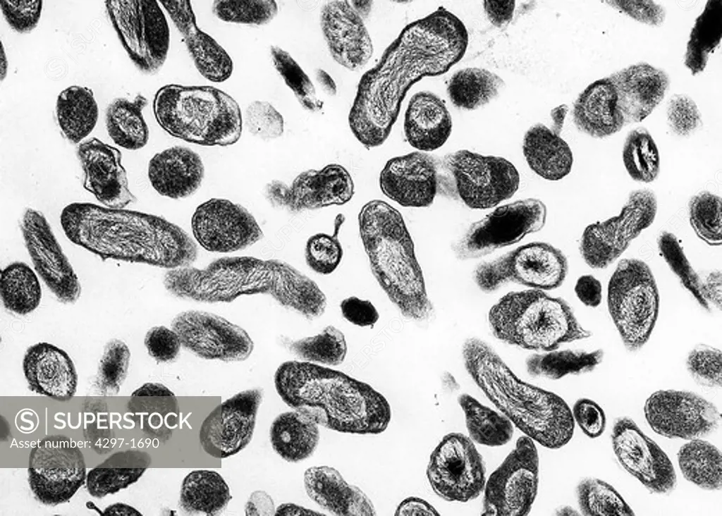 Transmission electron micrograph of Coxiella burnetii, the bacteria that causes Q fever