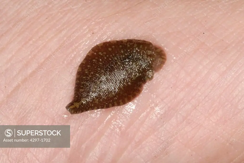 Placobdella leech in the family Glossiphoniidae, known as freshwater jawless leeches or glossiphoniids. They are one of the main groups of Rhynchobdellida, true leeches with a proboscis
