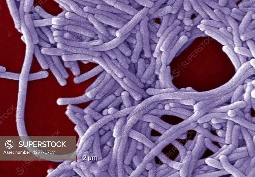 SEM image of Gram-negative Legionella pneumophila bacteria