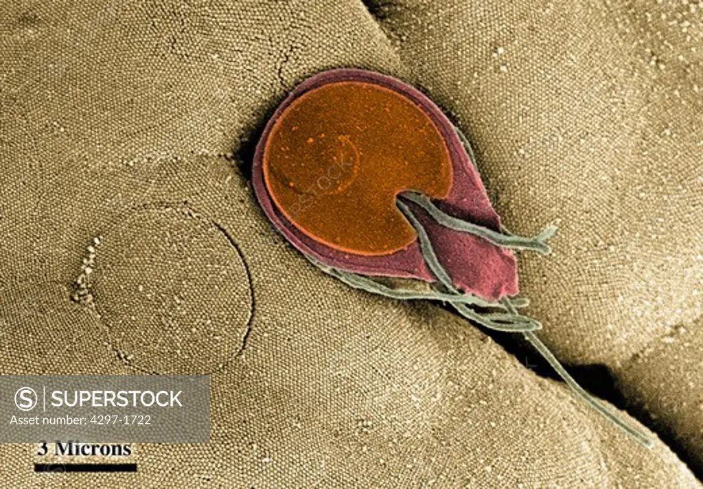 Scanning electron micrograph of the ventral surface of a Giardia trophozoite. SEM showing a circular lesion on the intestine (on the left) produced by the ventral adhesive disk of a Giardia protozoan