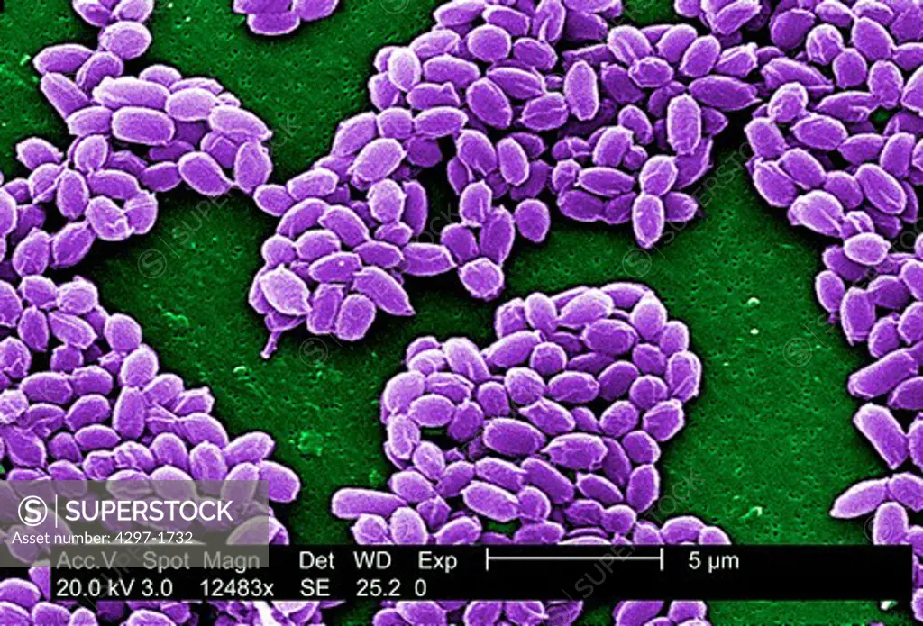 SEM of Anthrax bacteria spores (Bacillus anthracis)