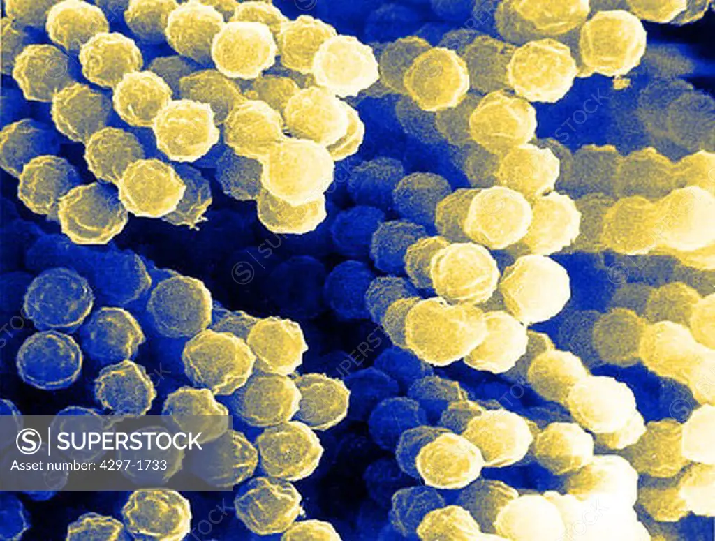 SEM image of Aspergillus fungus