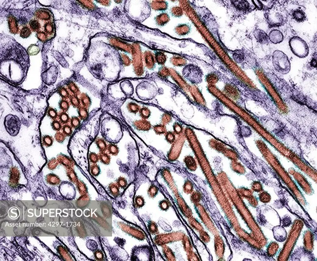 TEM (transmission electron micrograph) of Avian influenza A H5N1 viruses (seen in brown) grown in MDCK cells (seen in purple)