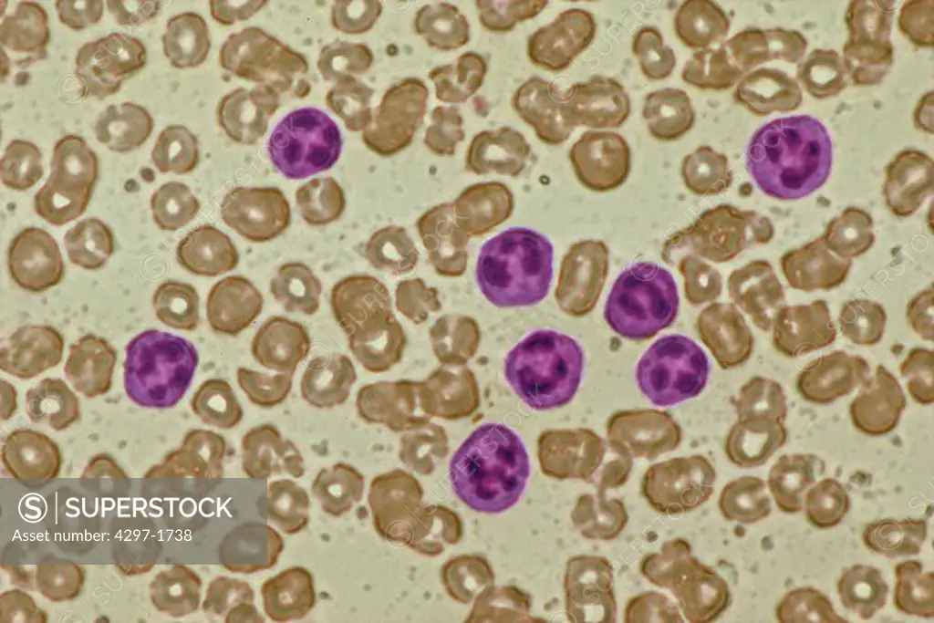 Light micrograph of normal human blood cells
