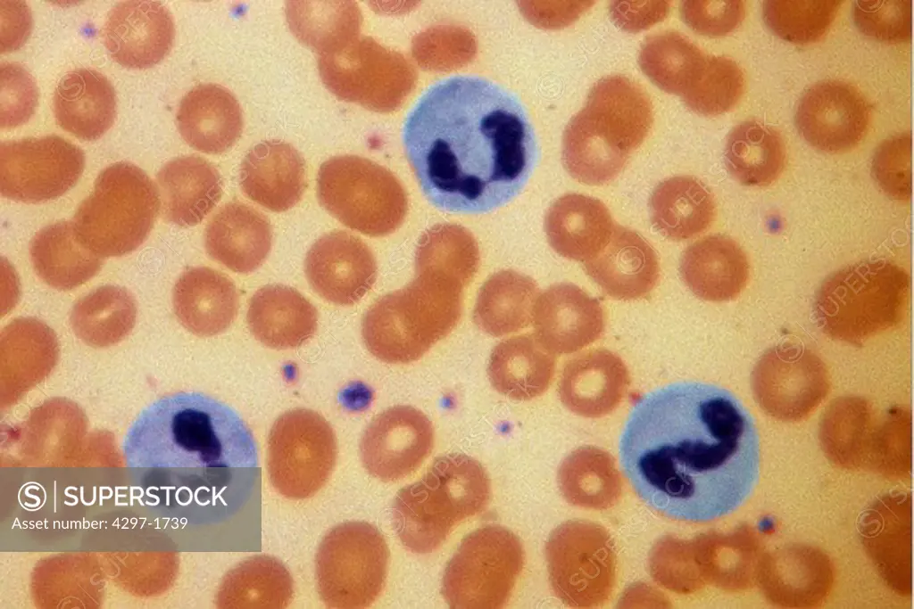 Light micrograph of normal human blood cells