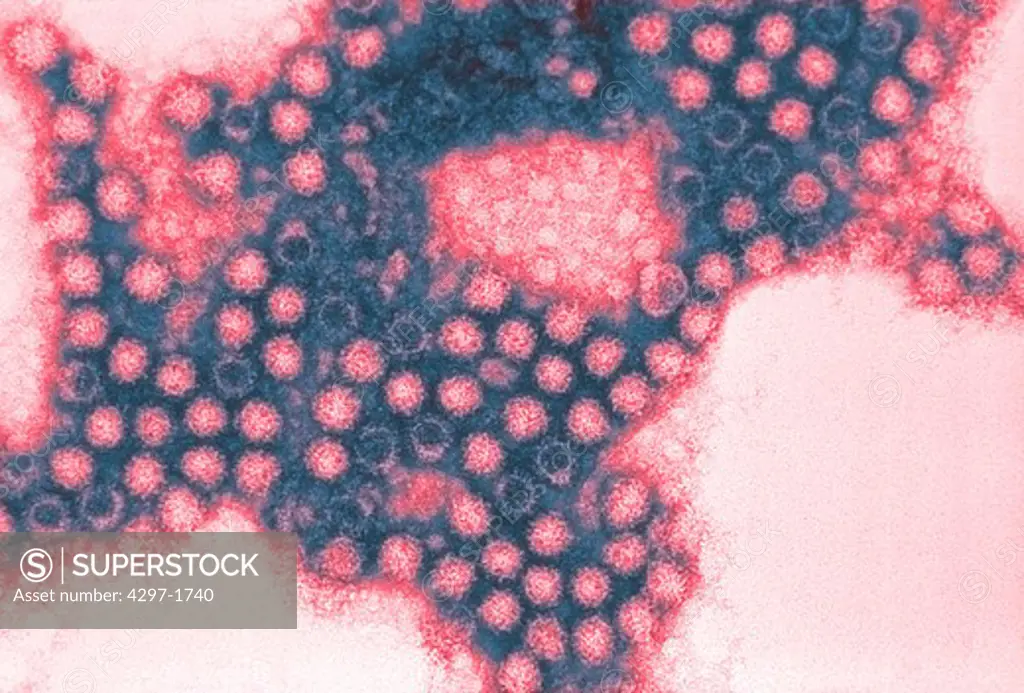 Electron microscope image showing negatively stained Feline calicivirus (FCV)