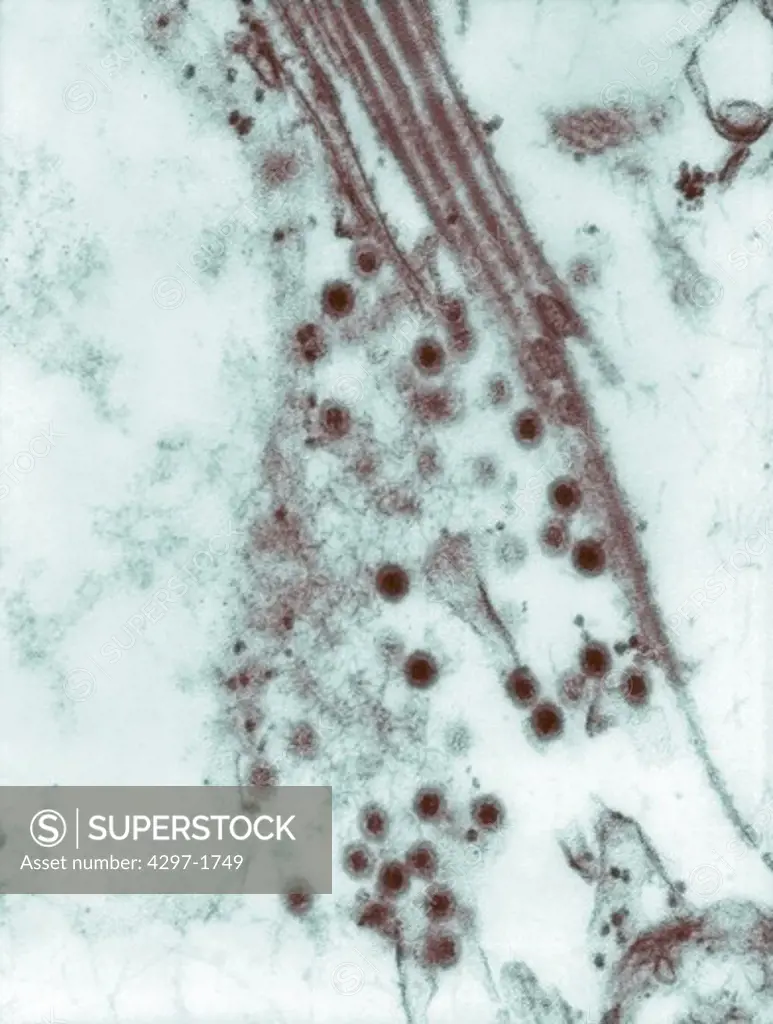 Transmission electron micrograph of Colorado tick fever virus (CTFV)