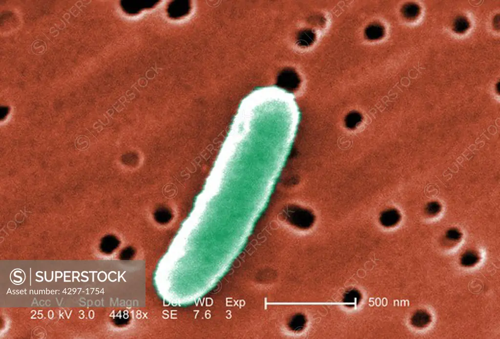 A single Gram-negative Escherichia coli bacterium at an extremely high magnification of 44, 818X. This bacterium is a member of the strain, 0:169 H41 ETEC (Enterotoxigenic E. coli)