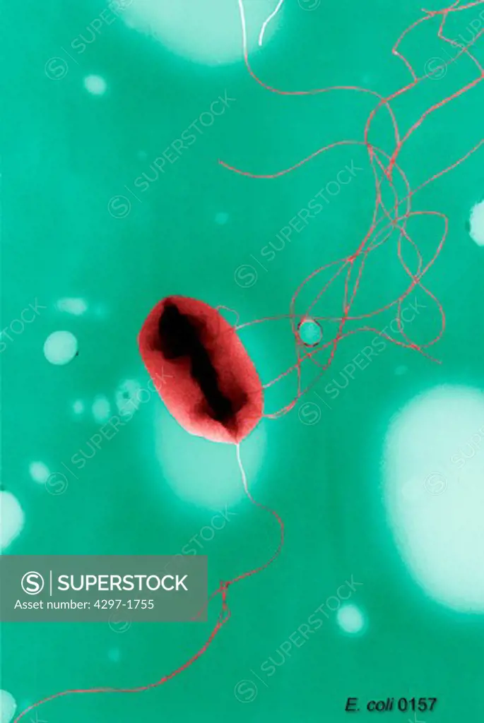 Colorized scanning electron micrograph of a single Gram-negative Escherichia coli bacterium
