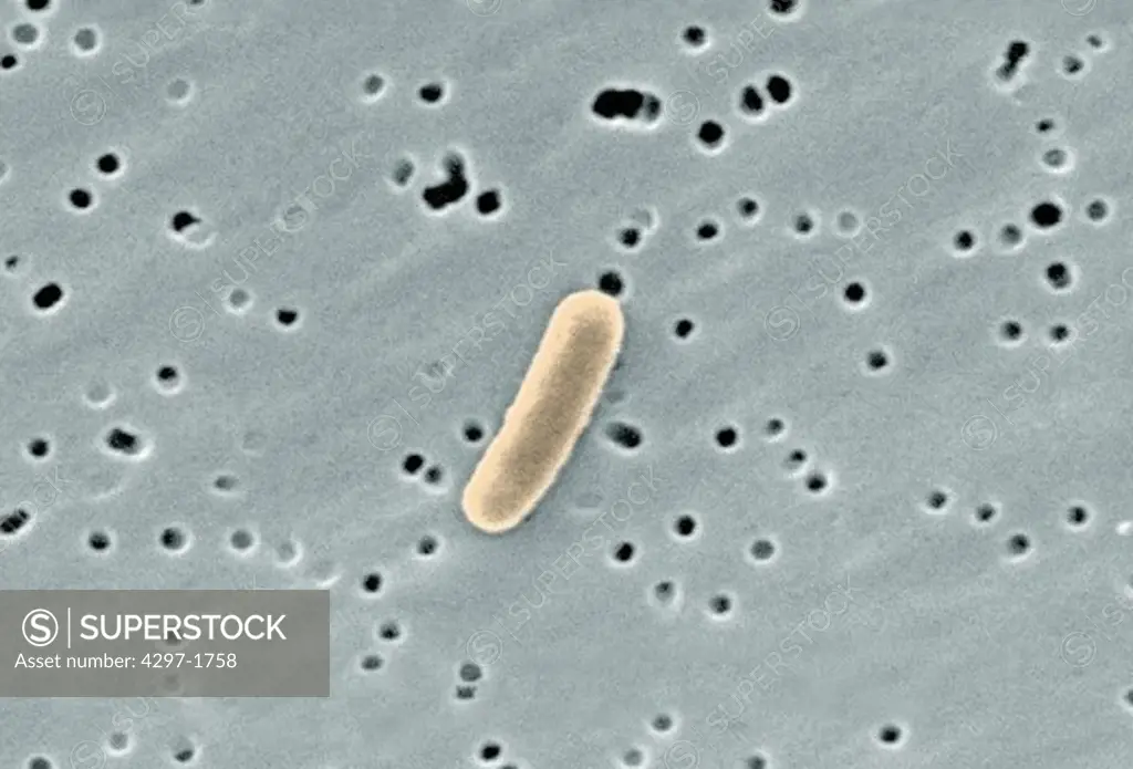 Single Gram-negative Escherichia coli bacterium