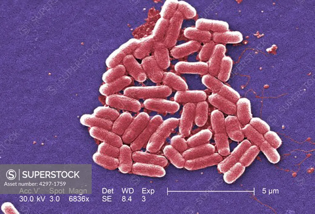 Colorized scanning electron micrograph of E. coli O157:H7 at a magnification of 6836x. Pseudoreplica technique. Escherichia coli is a Gram-negative bacterium that normally colonizes the digestive tract of most warm-blooded animals, including human beings