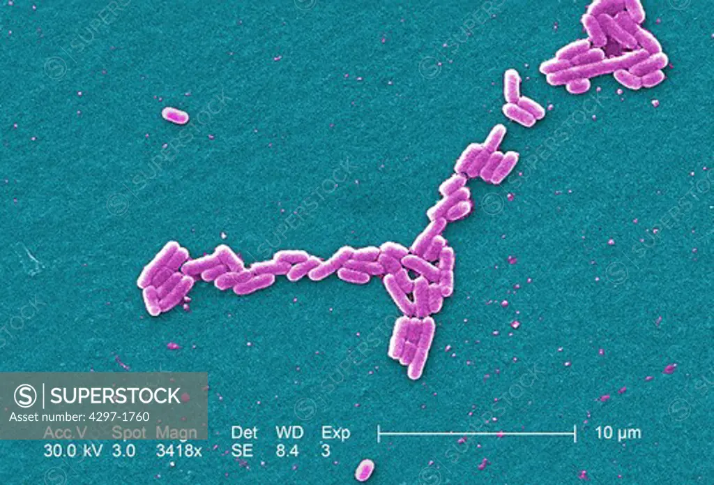 Colorized scanning electron micrograph of E.coli O157:H7 at a magnification of 3418x.Escherichia coli bacteria of the strain O157:H7.E.coli O157:H7 is one of hundreds of strains of this bacterium