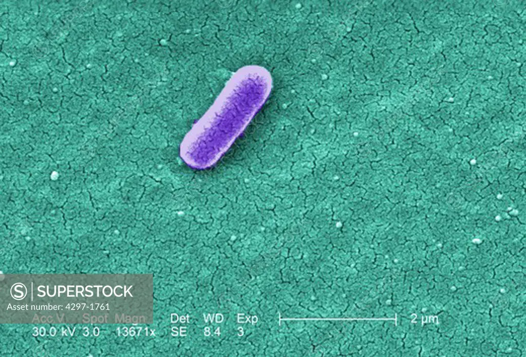 Colorized scanning electron micrograph of E.coli O157:H7 at a magnification of 13671x.Escherichia coli bacteria of the strain O157:H7.E.coli O157:H7 is one of hundreds of strains of this bacterium