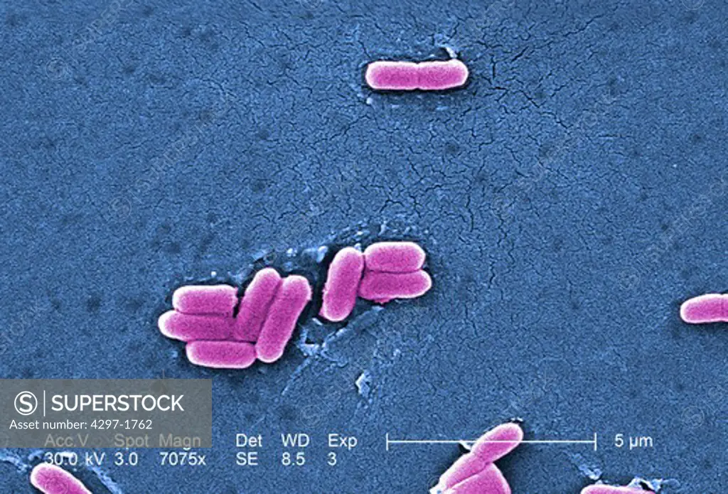 Colorized scanning electron micrograph of E.coli O157:H7 at a magnification of 7075x.Escherichia coli bacteria of the strain O157:H7.E.coli O157:H7 is one of hundreds of strains of this bacterium