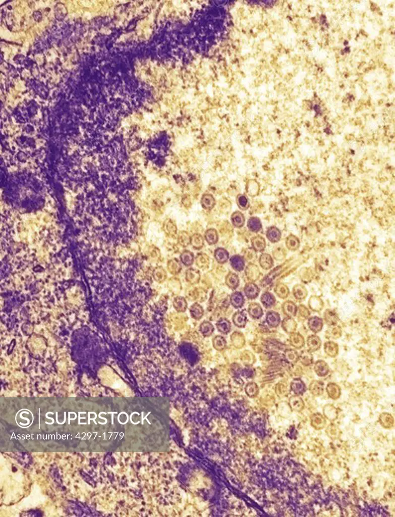 Negatively-stained transmission electron micrograph of numerous herpes simplex virions, members of the Herpesviridae virus family