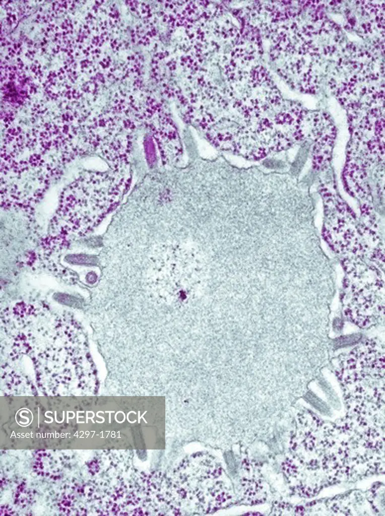 Transmission electron micrograph of Lagos bat virus (LBV) virions and an intracytoplasmic inclusion body in a tissue sample