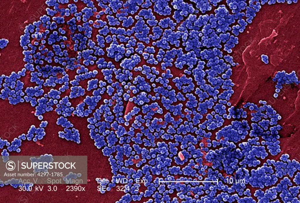 Scanning Electron Micrograph (SEM) of methicillin-resistant Staphylococcus aureus bacteria, commonly known as MRSA
