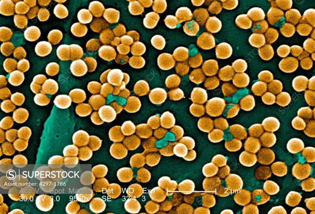 Scanning Electron Micrograph (SEM) of methicillin-resistant Staphylococcus aureus bacteria, commonly known as MRSA