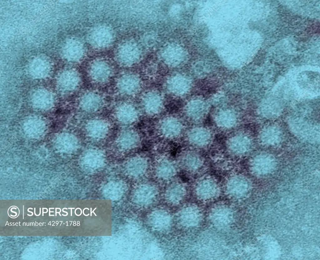 TEM image of norovirus virions