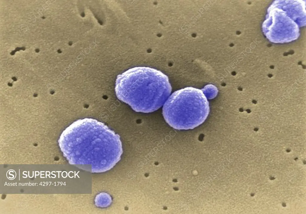 SEM image of Gram-positive Streptococcus pneumoniae bacteria