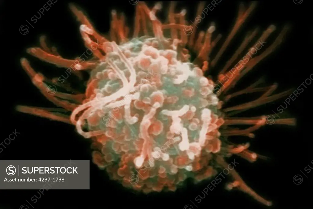 SEM image of a human white blood cell