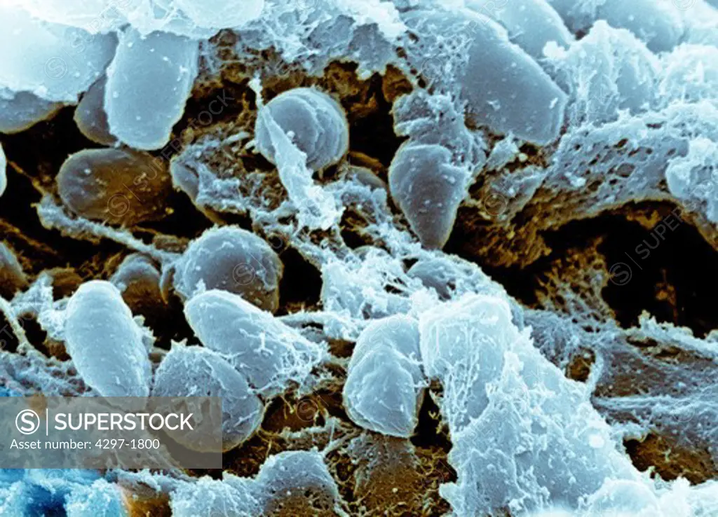 Colorized SEM image of Yersinia pestis bacteria