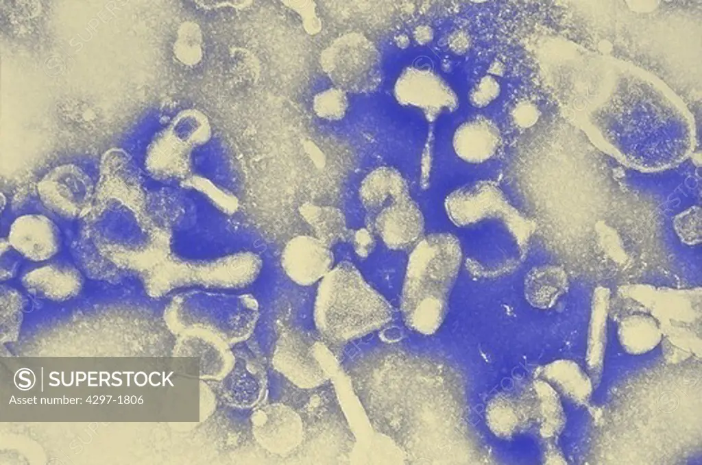 Electron micrograph of the Feline Leukemia Virus