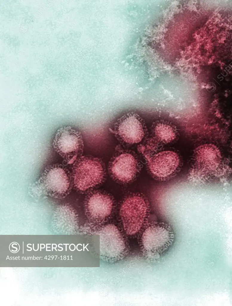 The influenza A virus is a Orthomyxoviridae virus family member, and was responsible for the flu pandemic of 1968-1969, which infected an estimated 50,000,000 people in the United States, killing 33,000