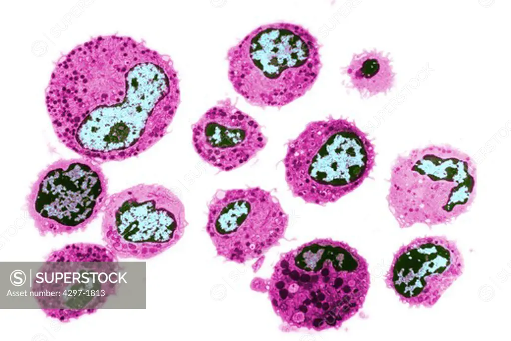 Colorized TEM image of human white blood cells
