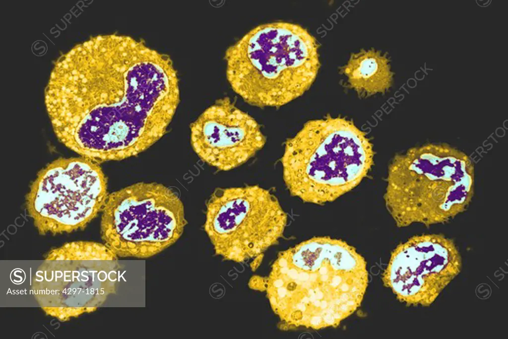 Colorized TEM image of human white blood cells