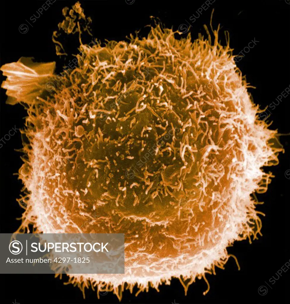 SEM image of a human macrophage