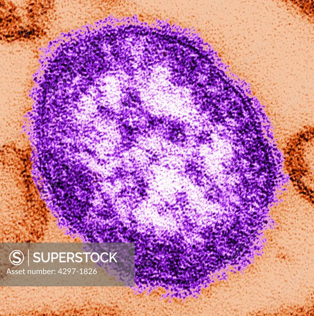 Thin-section transmission electron micrograph of a single measles virus particle or virion
