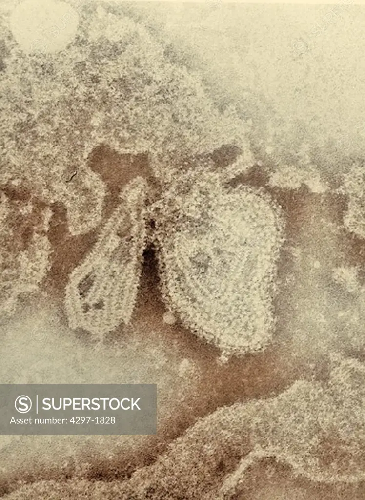 Negative stained TEM image of mumps virus