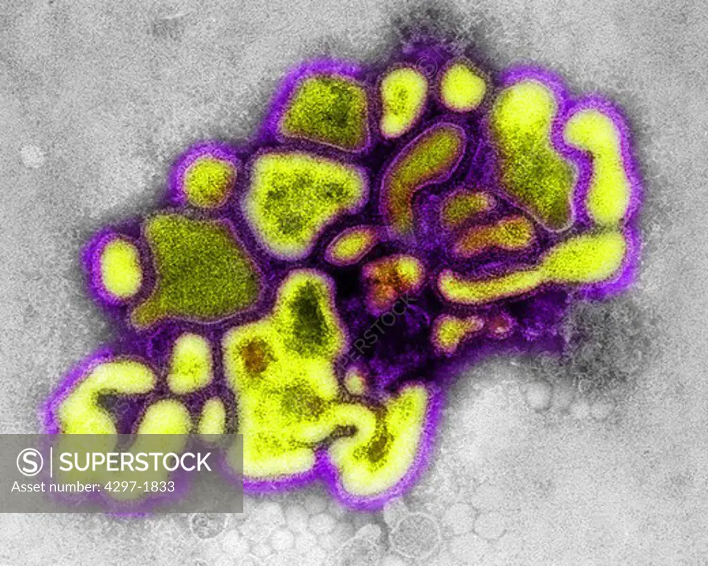 Transmission electron micrograph of the A/New Jersey/76, HSW1N1, virus, a type of swine flu virus, magnification of 37,800X