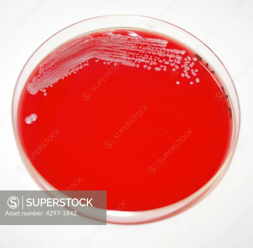 Petri dish containing a sheep's blood agar medium which had been inoculated with Gram-negative Yersinia pestis bacteria the pathogen responsible for causing human plague