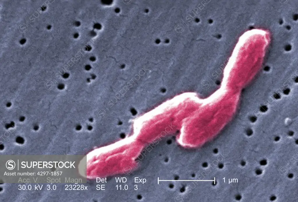 Scanning electron microscopic image of Salmonella bacteria