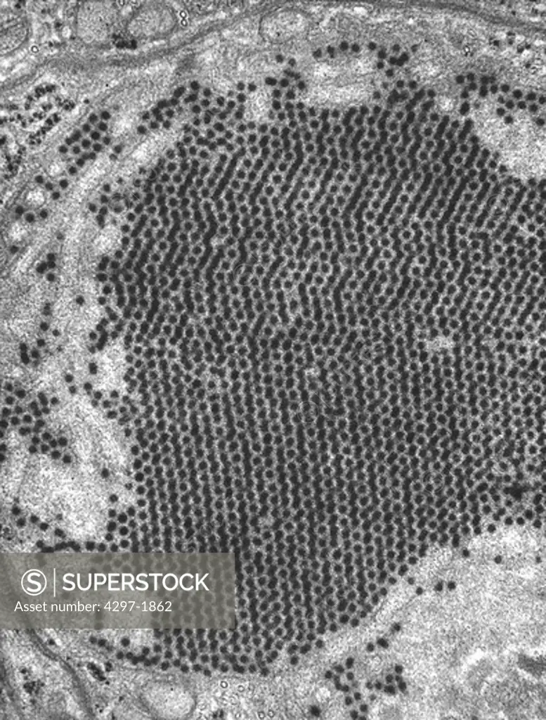 Micrograph of St. Louis encephalitis virus member of the genus Flavivirus