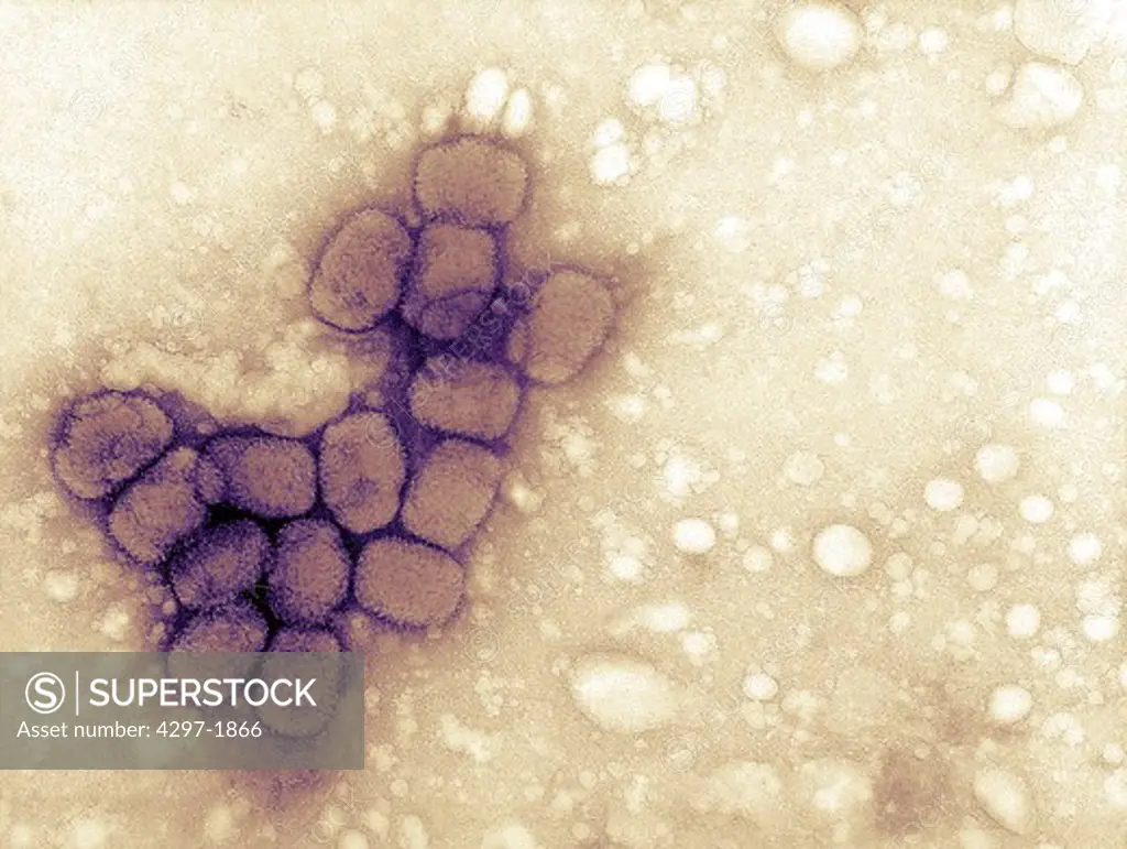 Scanning electron microscopic image of Smallpox virus highly contagious infectious disease