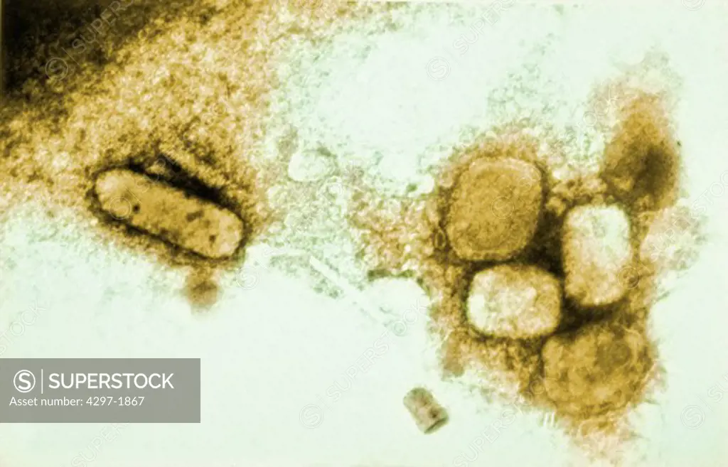 Scanning electron microscopic image of Smallpox virus highly contagious infectious disease