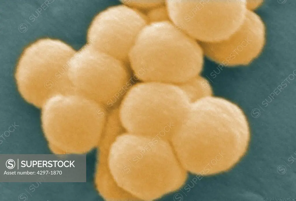 Scanning electron microscopic image of Streptococcus bacteria