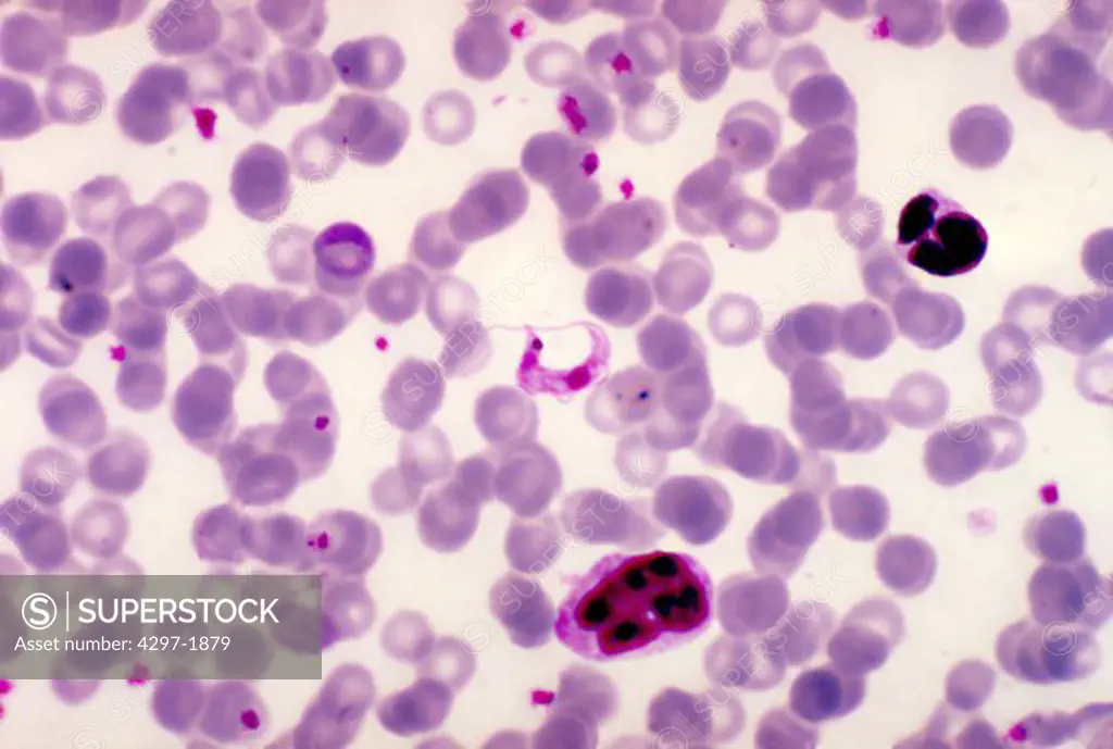 Light photomicrograph of a rat blood smear showing Trypanosoma lewisi parasites, using a Giemsa stain technique