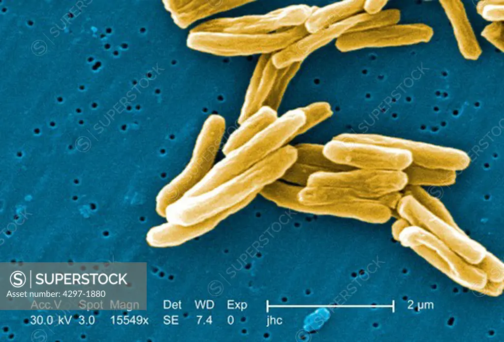 Scanning electron microscopic image showing ultrastructural details seen in the cell wall configuration of a number of Gram-positive Mycobacterium tuberculosis bacteria, under a high magnification of 15549x