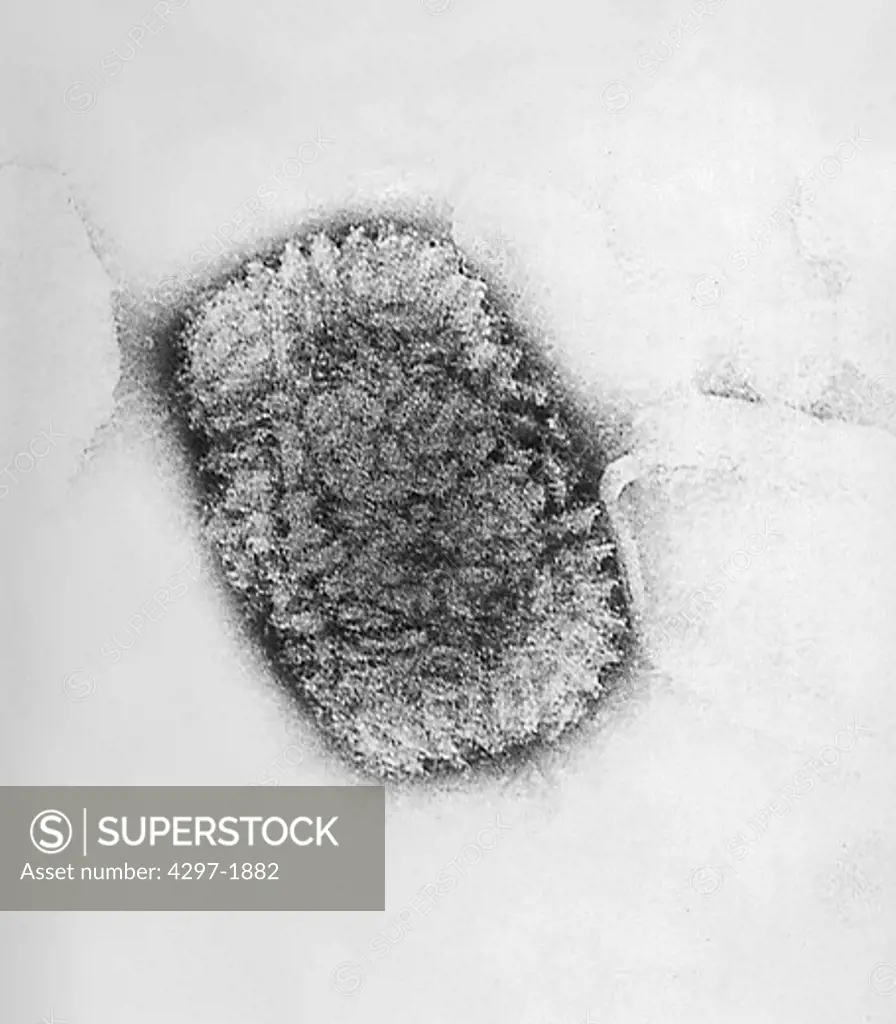 Scanning electron microscopic image of a Vaccinia virus