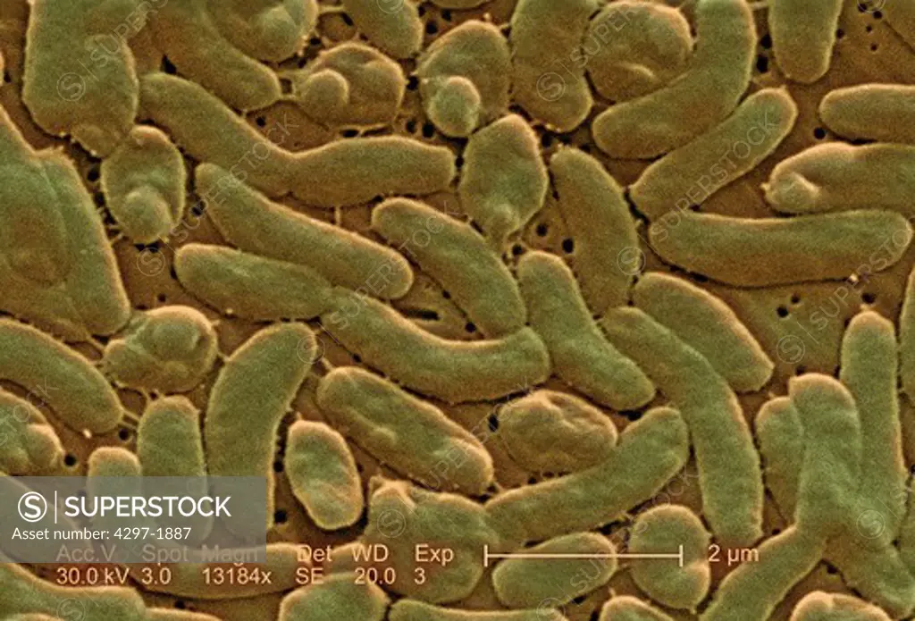 Scanning electron microscopic image of Vibrio vulnificus bacteria