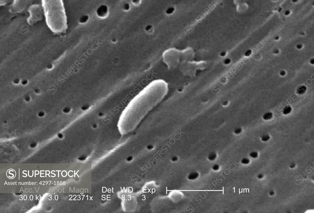 Scanning electron microscopic image of Vibrio cholerae bacteria of the serogroup 01