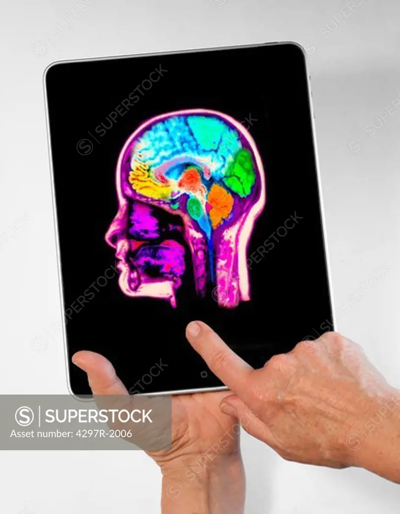 Digital tablet showing an x-ray of a colorized MRI scan of the brain