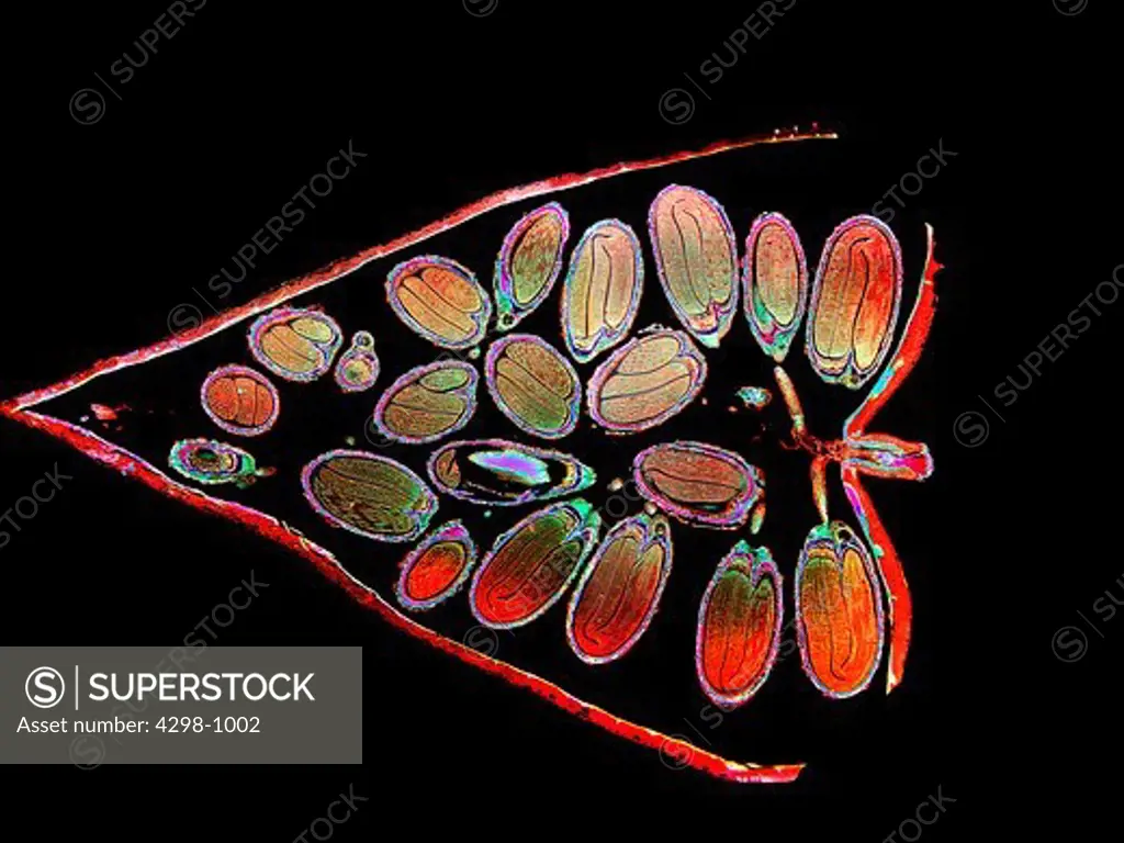 Capsella (Schefflera) embryo in ovary, magnification, imaged enhanced