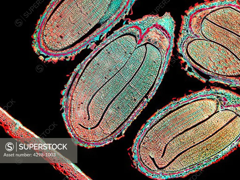 Capsella (Schefflera) embryo in ovary, magnification 40x, imaged enhanced
