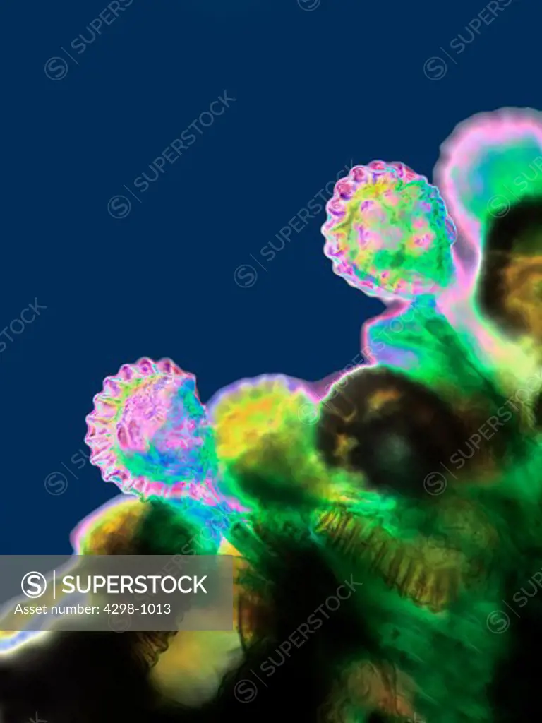 Japanese holly fern (Cyrtomium sp) sporangia, magnification 200x, image enhanced